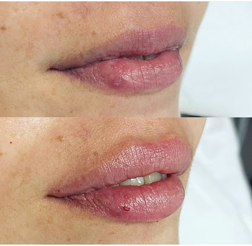 Clínica Corpos Medicina Estética La Eliana en L'Eliana, Valencia