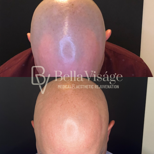 Explore tattoo ideas for female half sleeve, creative tattoo ideas in Lakeland, available at Bella Visge Medical & Aesthetic Rejuvenation