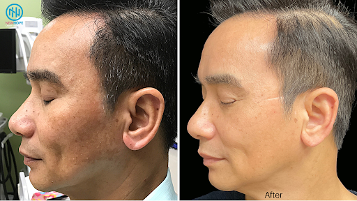 Explore tattoo ideas rose, creative tattoo ideas in Westminster, available at Newhope Laser Skin Care