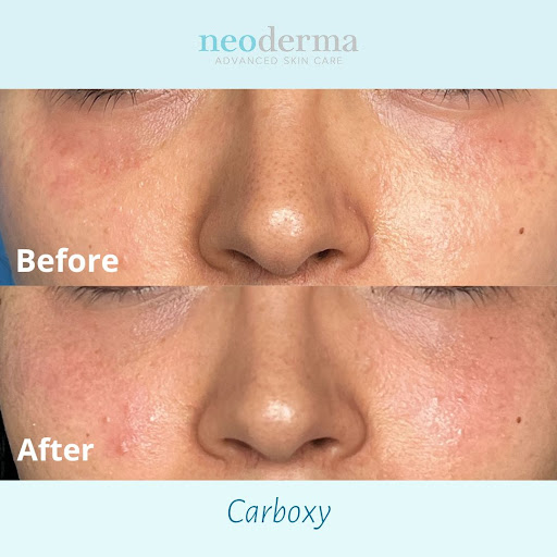 Explore bad bunny tattoos ideas, creative tattoo ideas in Anaheim, available at Neoderma