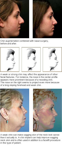 Zormeier Cosmetic Surgery and Longevity Center image