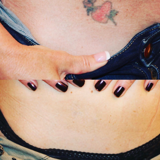 Explore uncharted tattoo ideas, creative tattoo ideas in Summit, available at Ethos Aesthetics and Wellness, Laser Hair Removal and Med Spa