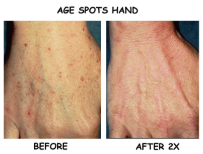 Explore terrifier tattoo ideas, creative tattoo ideas in Englewood, available at Laser Remedy Skin Solutions