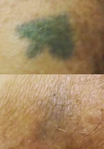 Explore prodigal son tattoo ideas, creative tattoo ideas in Weatherford, available at Vanish Laser Tattoo Removal and Skin Aesthetics