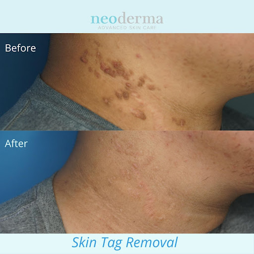 Explore mens thumb tattoo ideas, creative tattoo ideas in Anaheim, available at Neoderma