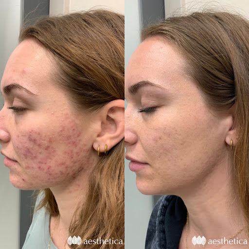 Explore pepe le pew tattoo ideas, creative tattoo ideas in Pleasant Grove, available at Aesthetica