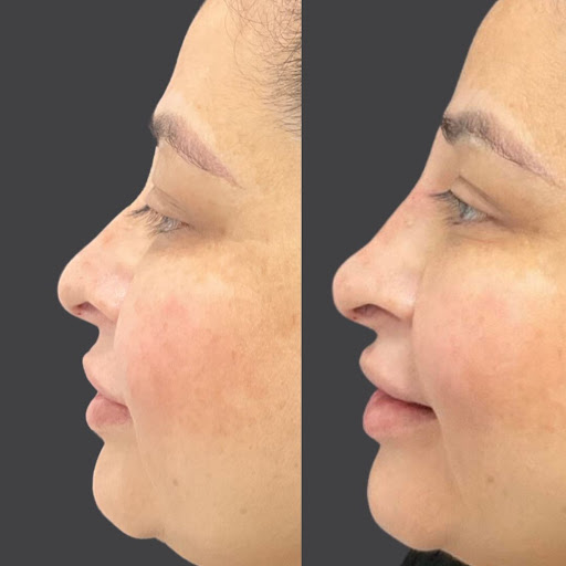 Explore boyfriend name tattoo ideas on chest, creative tattoo ideas in Whittier, available at Skin Perfect Medical Aesthetics