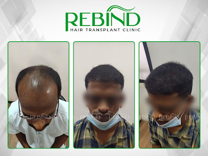 Rebind Hair Transplant Clinic Pune - 102, Rashmiraj Apartment, Rambhau K  Kamble Path, Pune, Maharashtra, IN - Zaubee