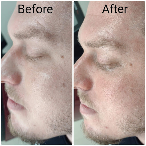 Explore gypsy hippie tattoo ideas, creative tattoo ideas in Brighton, available at Tip of the Spear Laser Esthetics