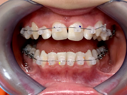 Orthoclinik Dental Natanael Valenzuela