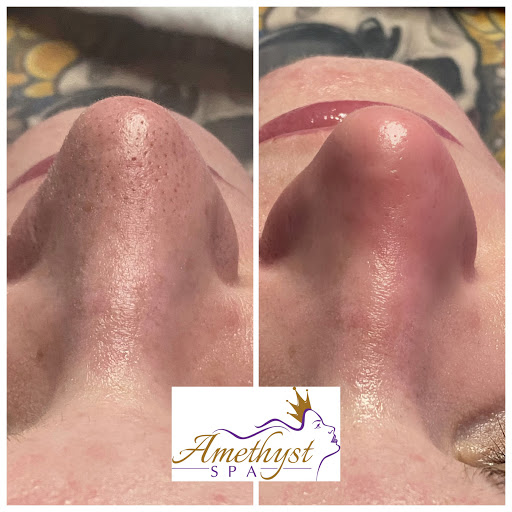 Explore bikini tattoo ideas, creative tattoo ideas in Omaha, available at Amethyst Spa