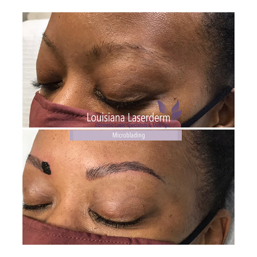 Explore full neck tattoo ideas, creative tattoo ideas in Baton Rouge, available at Louisiana Laserderm