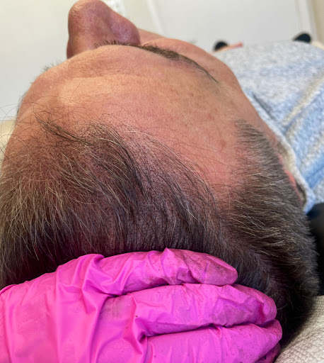 SMP Hair Clinic The Queen Of Scalp image