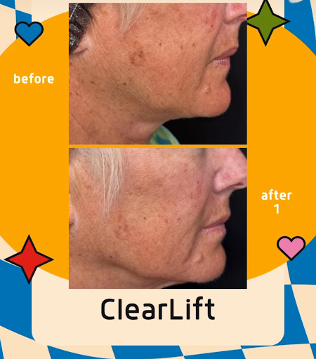 Explore black widow tattoo ideas, creative tattoo ideas in Portland, available at Take It Off Tattoo Removal and Alt Spa