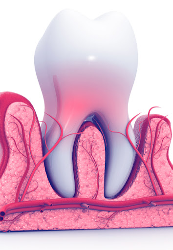 Bellflower Dental Group - Cosmetic and Emergency Dentist Bellflower image
