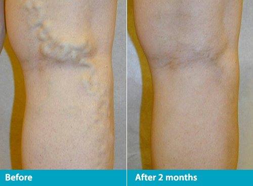 Beach Cities Vein and Laser Center image