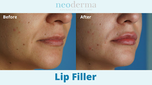 Explore women shoulder tattoo ideas, creative tattoo ideas in Anaheim, available at Neoderma