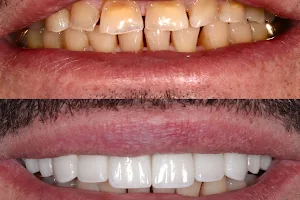 Beauty and the Teeth Dentistry: Dr. Diana Tadros image