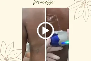 Glauce Costa - Estética e Pós Cirurgico image