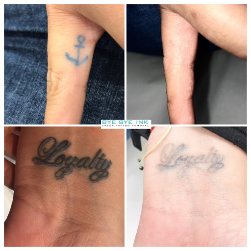 Explore small tribal tattoo ideas, creative tattoo ideas in Middle Village, available at Bye Bye Ink Laser Tattoo Removal