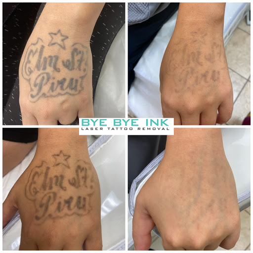 Explore sun and moon tattoo ideas, creative tattoo ideas in Middle Village, available at Bye Bye Ink Laser Tattoo Removal