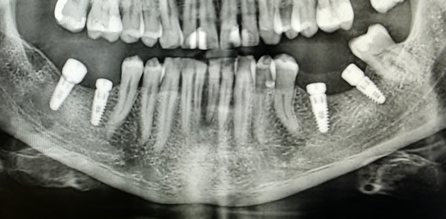 Avaliações doClínica Monalisa do Implante Dentário. em Campo Maior - Dentista