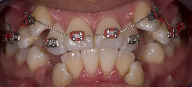 Comentarios y opiniones de DENTAR