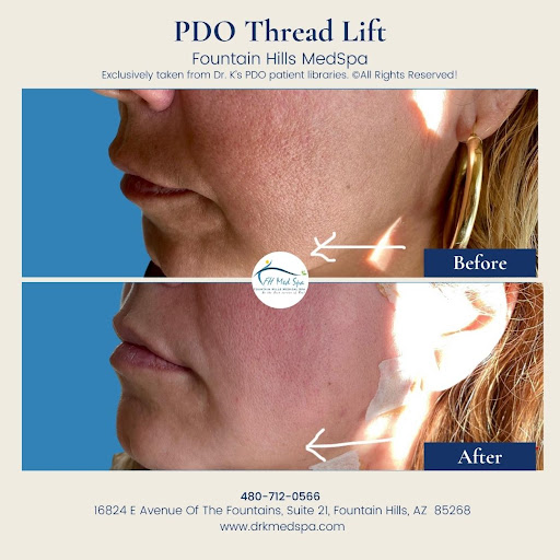 Pediatrician «Dr. Jyoti Patel MD - Fountain Hills Pediatrics & Internal Medicine», reviews and photos, 13620 N Saguaro Blvd #100, Fountain Hills, AZ 85268, USA