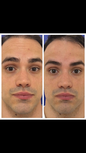 Medical Spa «Pur Skin Clinic», reviews and photos, 307 Bell St #104, Edmonds, WA 98020, USA