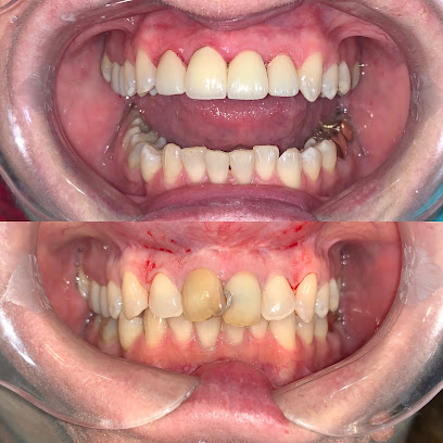 Edgewater Dentist- Universal Smiles Dentistry
