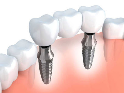 Maxilofacial e Implantes Dentales en Cuernavaca