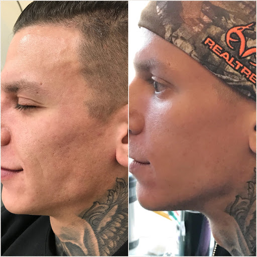 Explore polynesian tattoo ideas, creative tattoo ideas in Middle Village, available at Bye Bye Ink Laser Tattoo Removal