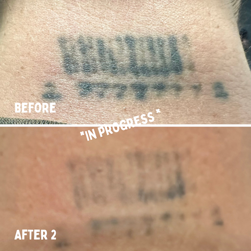 Explore song lyric tattoo ideas, creative tattoo ideas in Mckinney, available at Premier Tattoo Removal