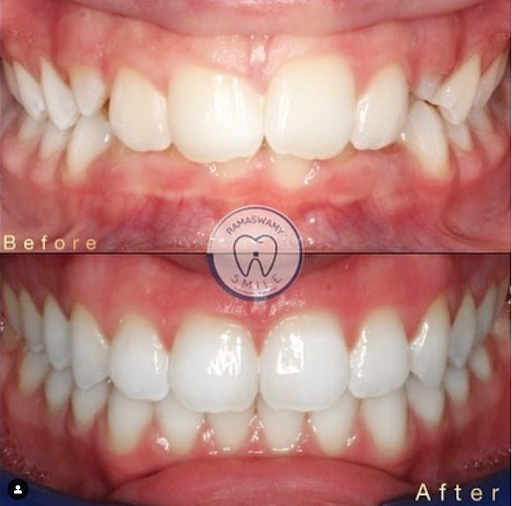Ramaswamy Smile Orthodontics - Braces, Invisalign Orthodontist image 9