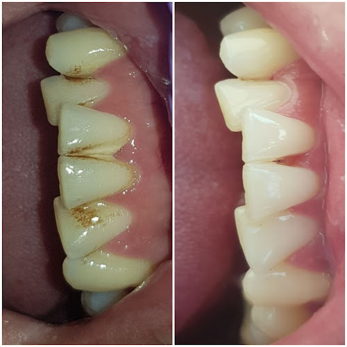 Opiniones de Clinica MAC Dental en Maipú - Dentista