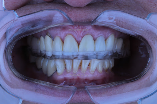 Saphire Dental Care - Cuautitlán Izcalli