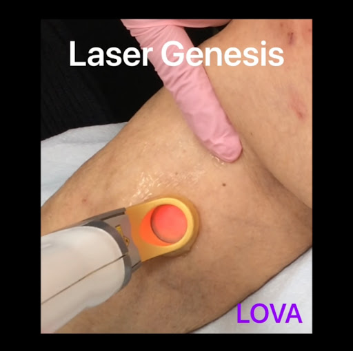 Explore mikasa tattoo ideas, creative tattoo ideas in Lake Oswego, available at Lake Oswego Vein and Aesthetic LOVA