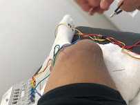 AC acupuncture - 广元中医 - Photo 3 - Car repair in Rosemead, CA, El Monte