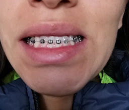 Sonrisas Mexicanas Revolución photo
