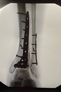 Brigham Au, MD - Photo 2 - Car repair in Arlington, TX, Arlington