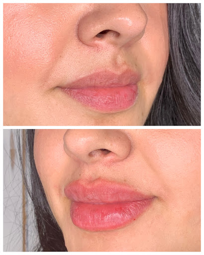 Explore black tattoo ideas for men, creative tattoo ideas in Eugene, available at Brighter Smiles Med Spa and Laser Center