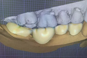 Design dental lab image
