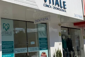 Vitale Clínica Odontológica | Aparelhos Dental em Ipatinga image