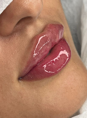 Lilyylips à Gignac-la-Nerthe