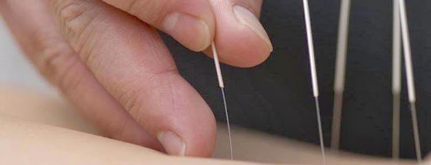 North Springs Acupuncture