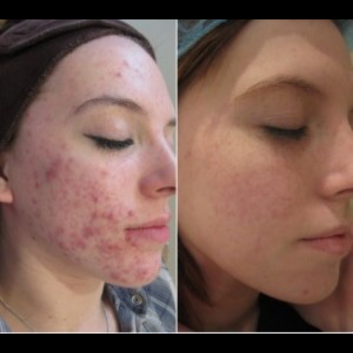 Explore boy mom tattoo ideas, creative tattoo ideas in Tucson, available at Allure Medical