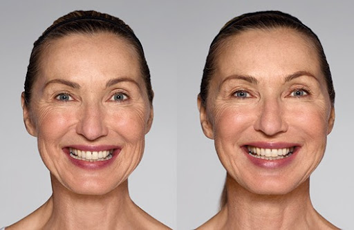 Zormeier Cosmetic Surgery and Longevity Center image