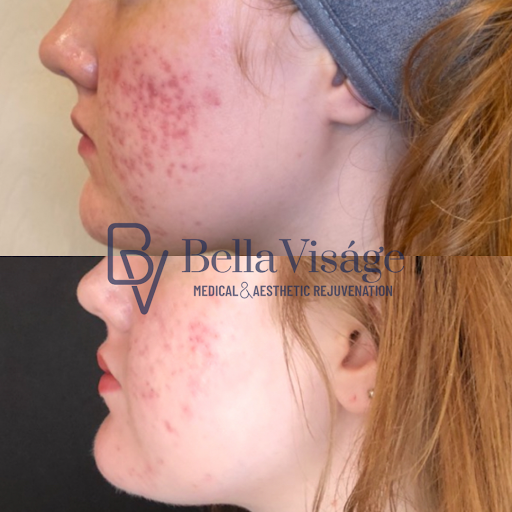 Explore movie tattoo ideas, creative tattoo ideas in Lakeland, available at Bella Visge Medical & Aesthetic Rejuvenation