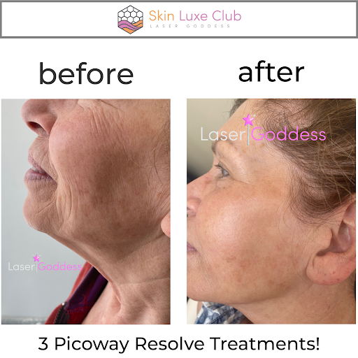 Explore marigold tattoo ideas, creative tattoo ideas in Bayside, available at Laser Goddess