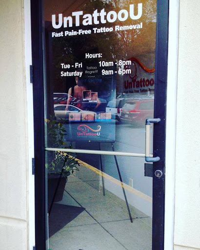 Explore good tattoo cover up ideas, creative tattoo ideas in Vienna, available at Removery Tattoo Removal & Fading